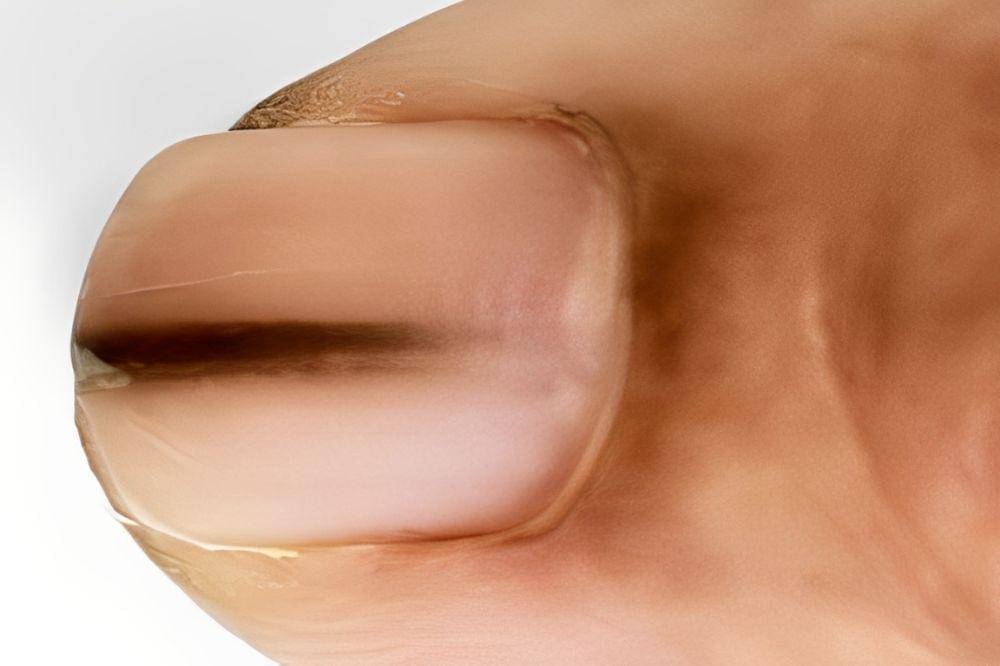 9 Tanda Masalah Kesehatan yang Terlihat dari Warna Kuku, Cek Sekarang! (3).jpg