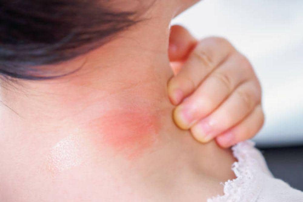 Bagaimana Bentuk Kelenjar Getah Bening? Kenali Bentuk dan Lokasinya!