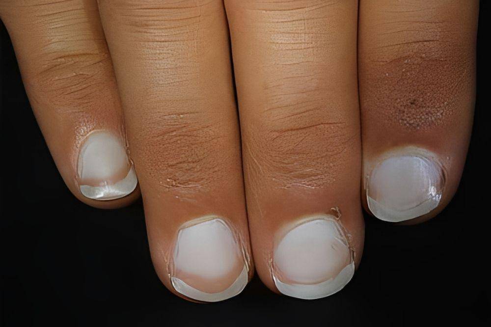 9 Tanda Masalah Kesehatan yang Terlihat dari Warna Kuku, Cek Sekarang!.jpg