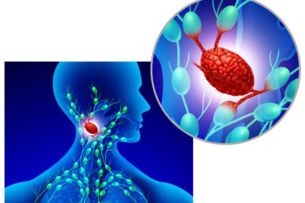 Bagaimana Bentuk Kelenjar Getah Bening? Kenali Bentuk dan Lokasinya!