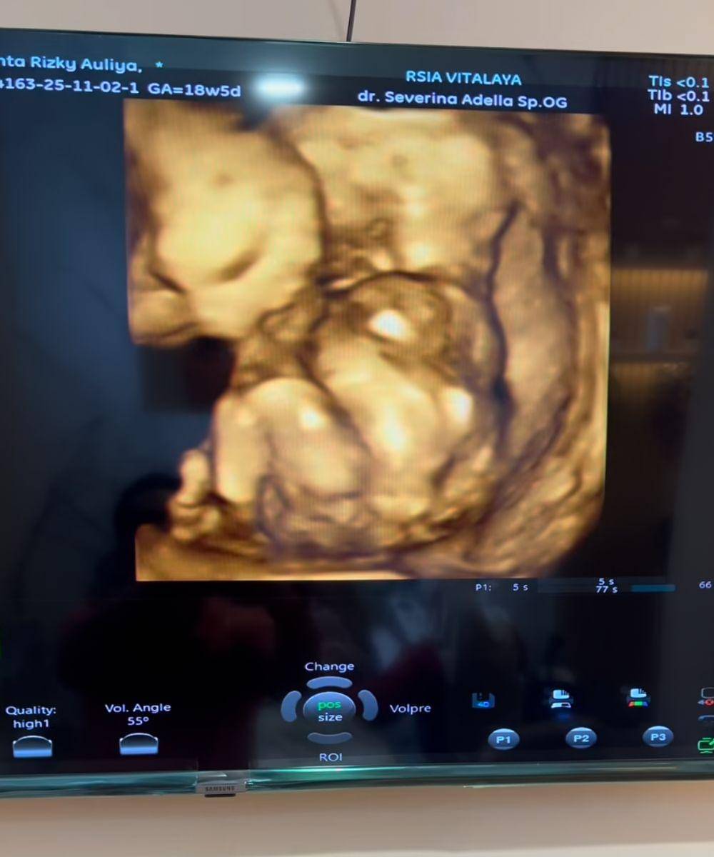 Instagram.com/chacathakya15