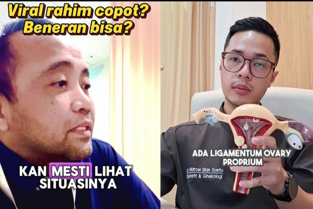 Heboh Rahim Copot, Ini Penjelasan dari Dokter! (1).jpg