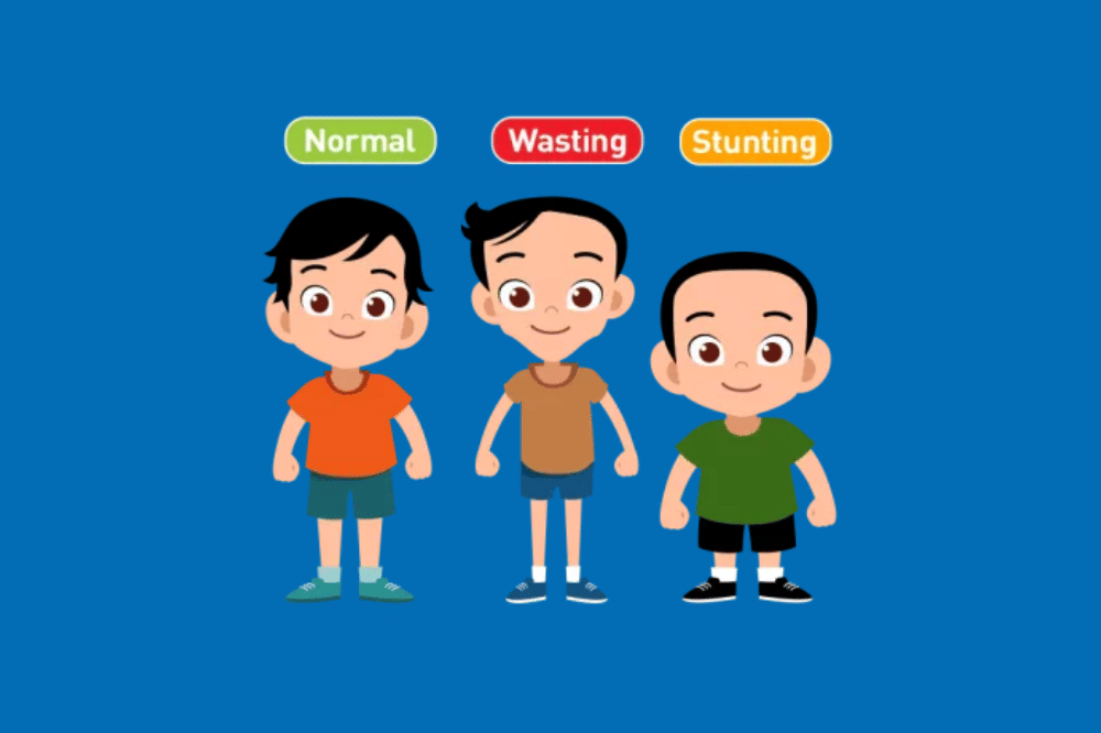 perbedaan wasting dan stunting