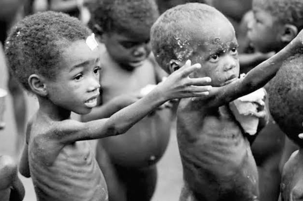 anak dengan gizi buruk