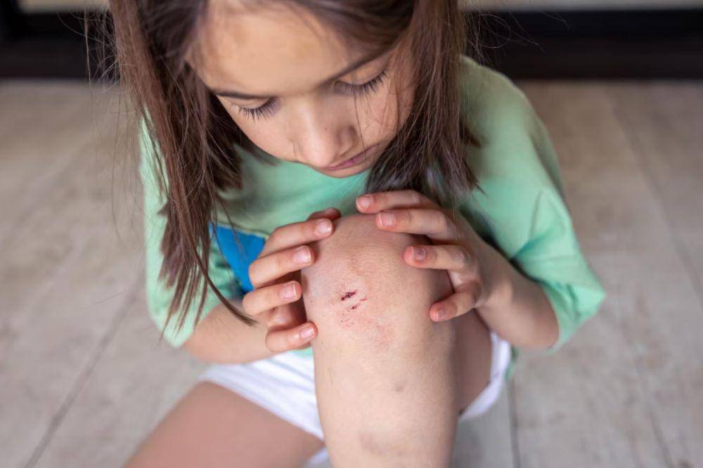 ilustrasi tersengat serangga