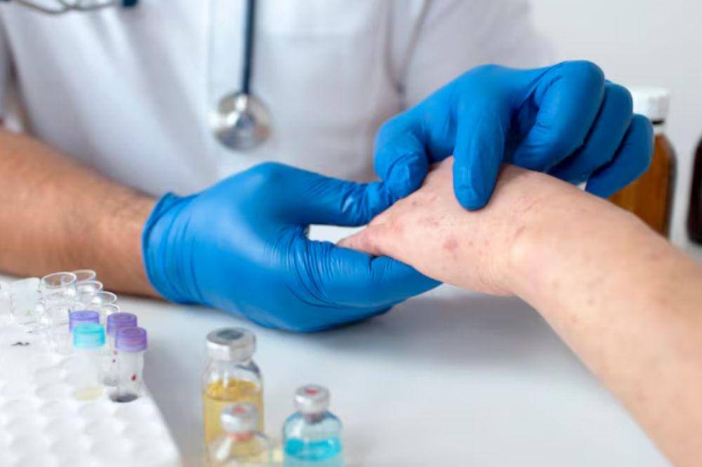 ilustrasi tersengat serangga