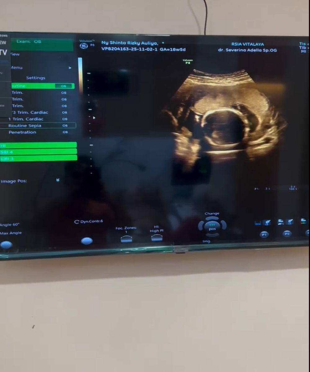 Instagram.com/chacathakya15