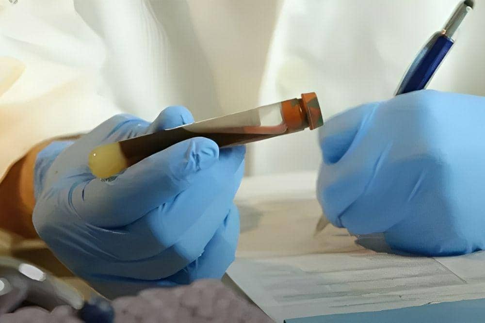 Golden Blood, Golongan Darah Super Langka yang Jarang Diketahui (3).jpg