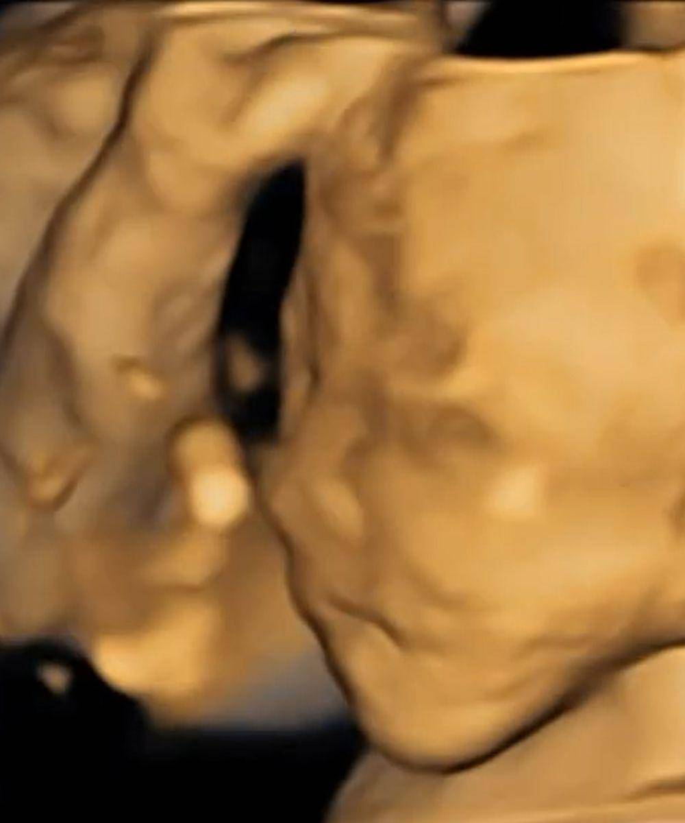 Nino membagikan hasil USG sang istri.jpg