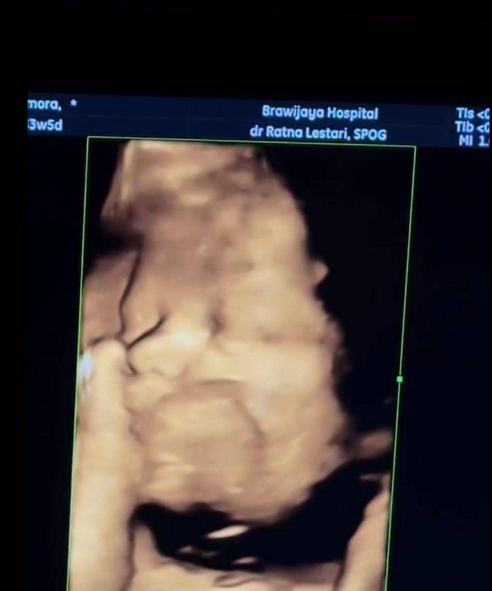 Instagram.com/steffizamoraaa