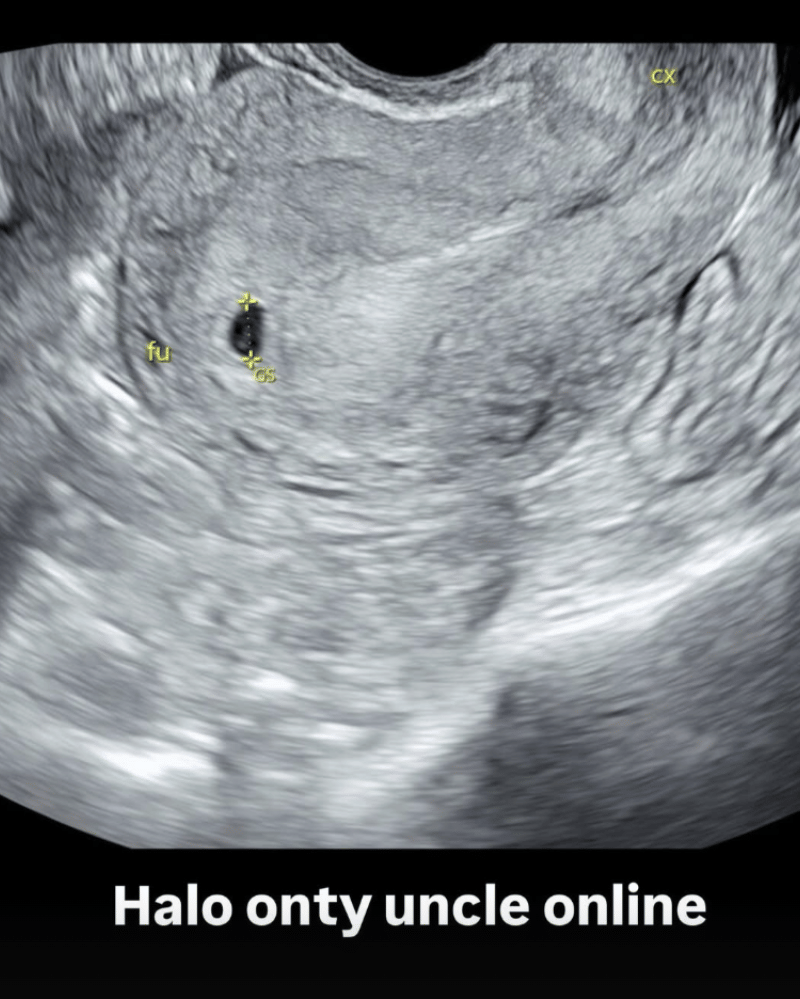 Instagram.com/amandamanopo