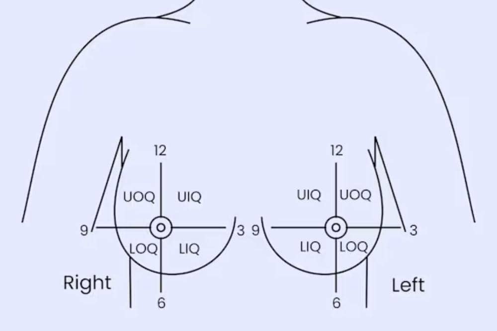 Benjolan Kanker Payudara Letaknya Dimana Ini yang Paling Umum (1).jpg