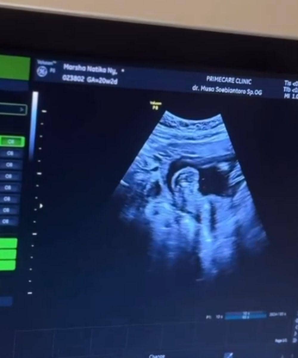 Instagram.com/marshanatika