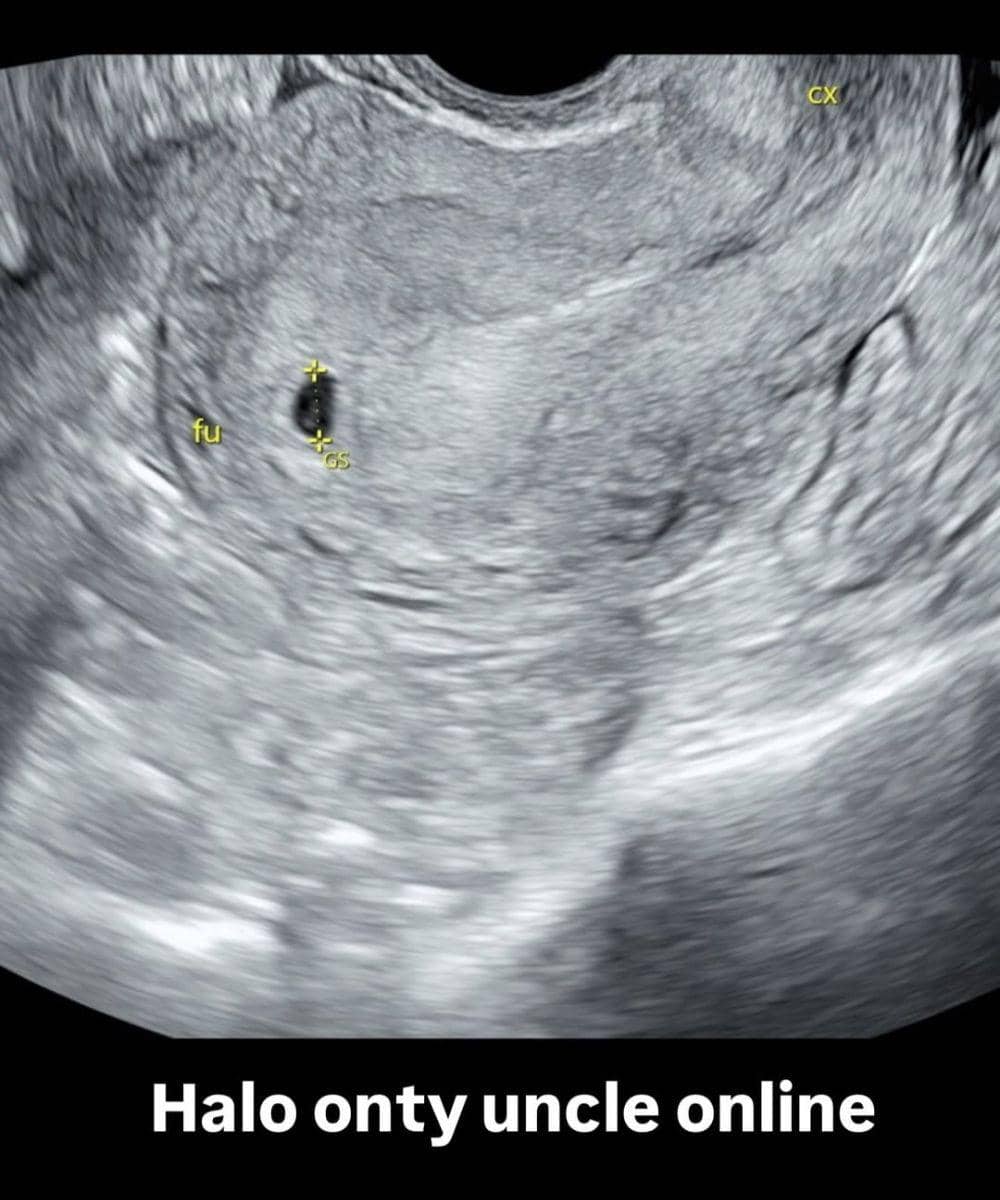 Instagram.com/amandamanopo