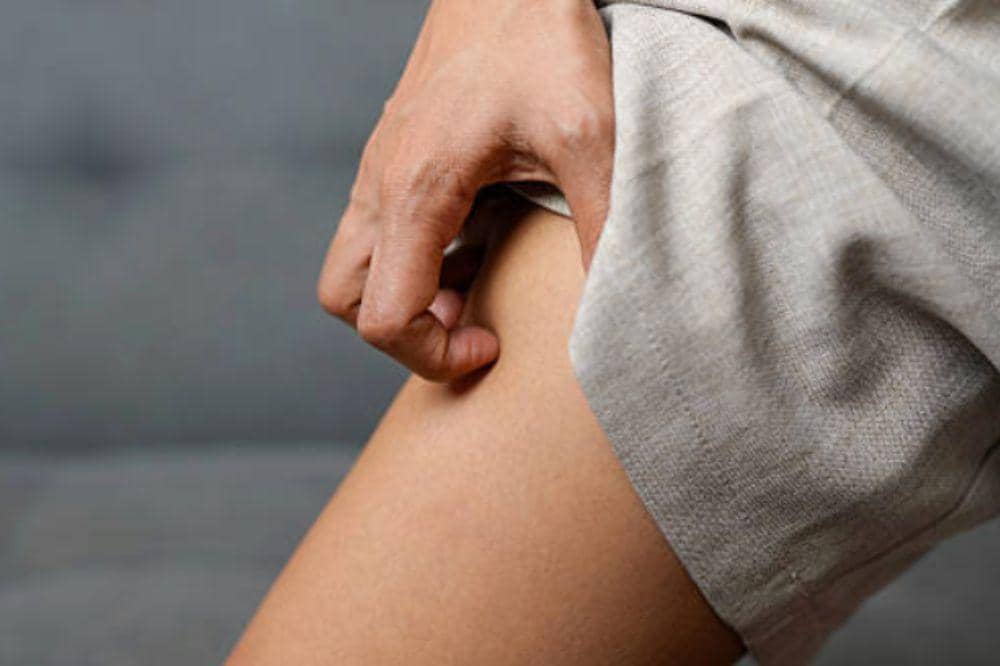 Bagaimana Cara Perawatan Diri untuk Biduran? Mudah Dilakukan!