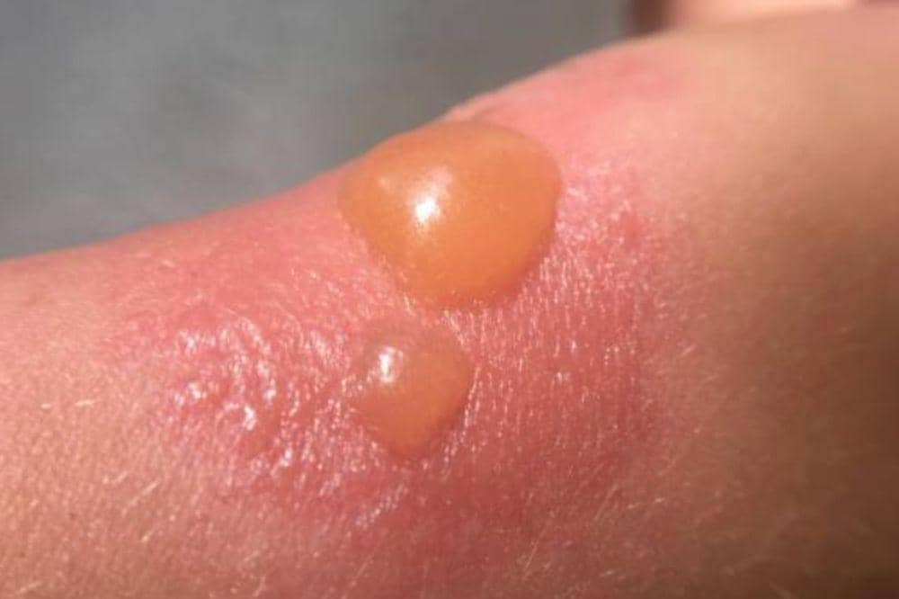 Istockphoto/Olegmalyshev