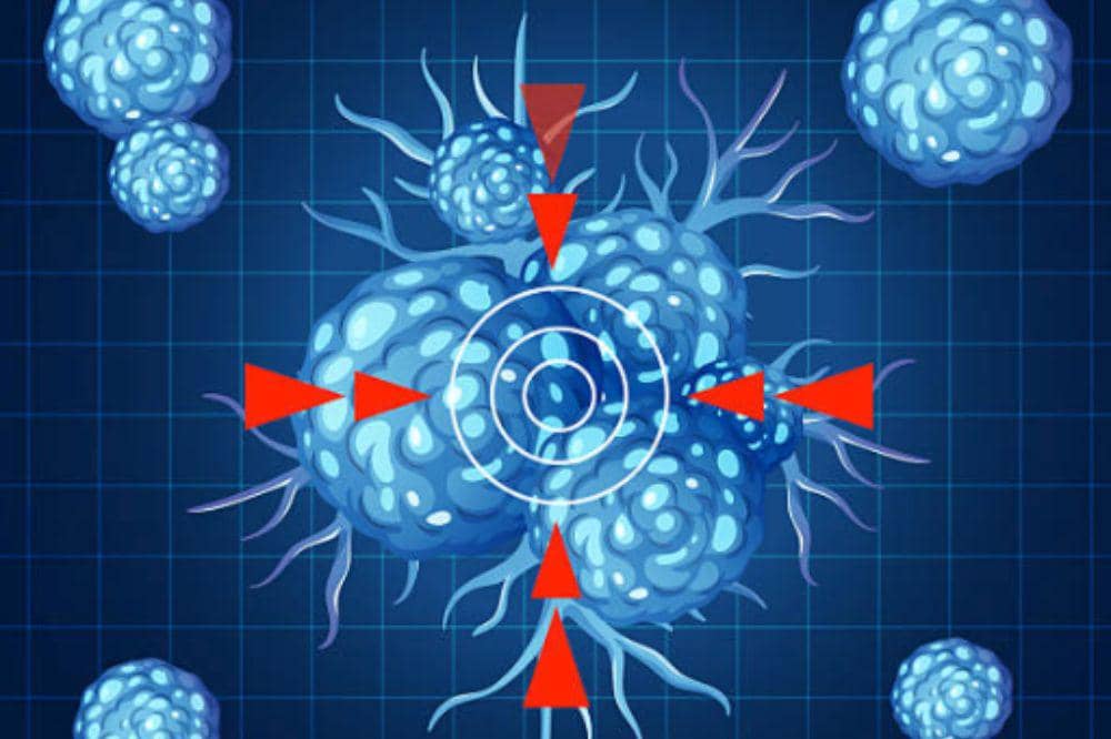  Bagaimana Cara Kerja Kemoterapi Kanker Payudara? Ini Penjelasannya!