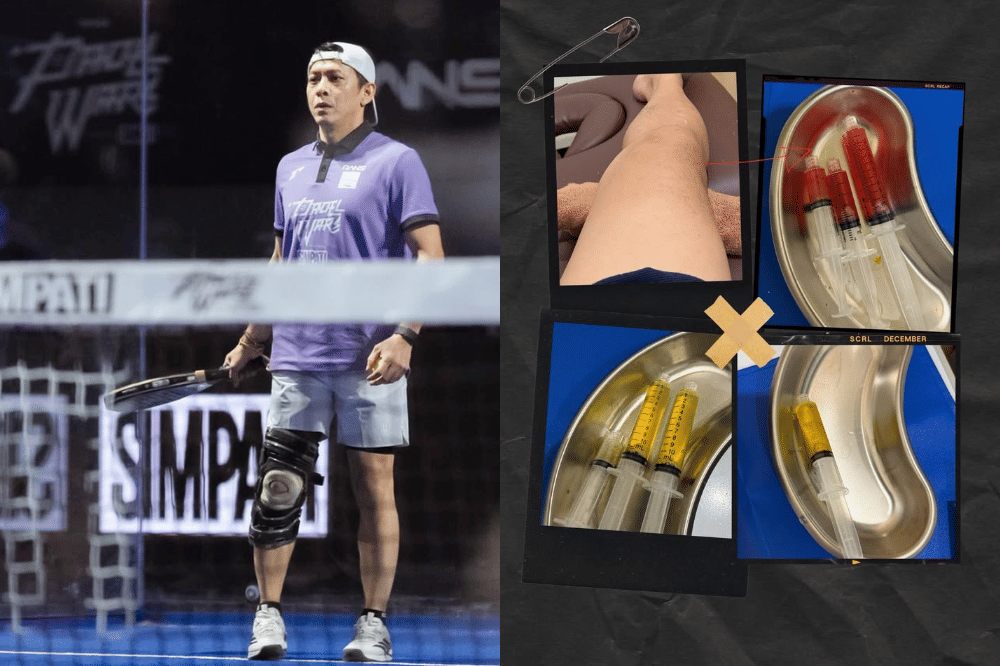 Apa Itu Cedera Meniscus yang Dialami Ariel NOAH? Ini Penjelasannya (7).png