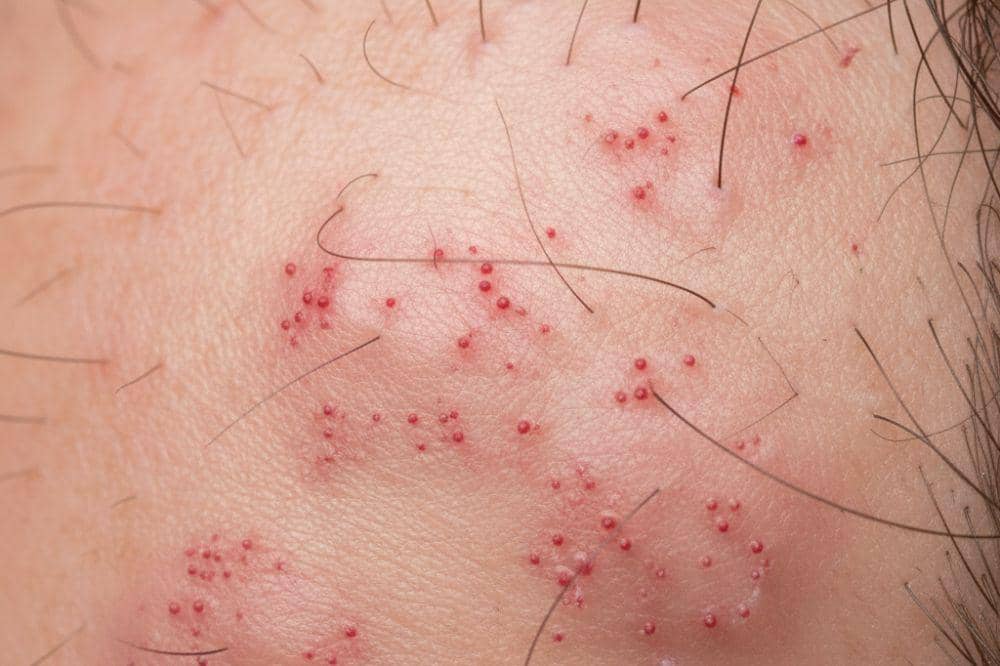 15 Tanda Tubuh Kekurangan Vitamin C, Jangan Tunggu Sampai Parah (3).jpg