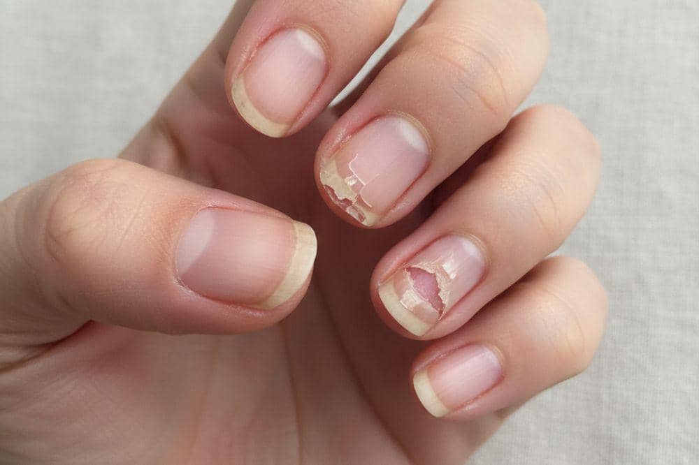 8 Tanda Tubuh Kekurangan Zinc, Berpengaruh pada Kualitas Sperma.jpg