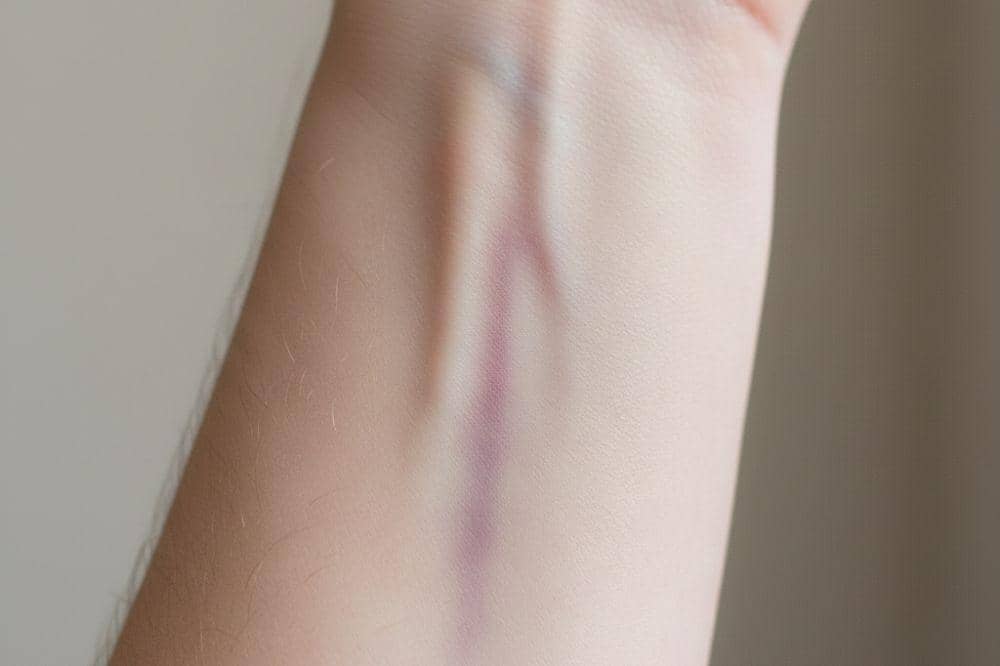 8 Tanda Tubuh Kekurangan Sel Darah Putih, Tubuh Jadi Rentan Infeksi.jpg