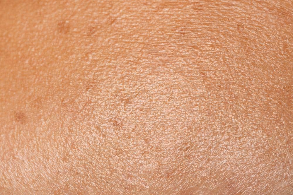 15 Tanda Tubuh Kekurangan Vitamin C, Jangan Tunggu Sampai Parah (5).jpg