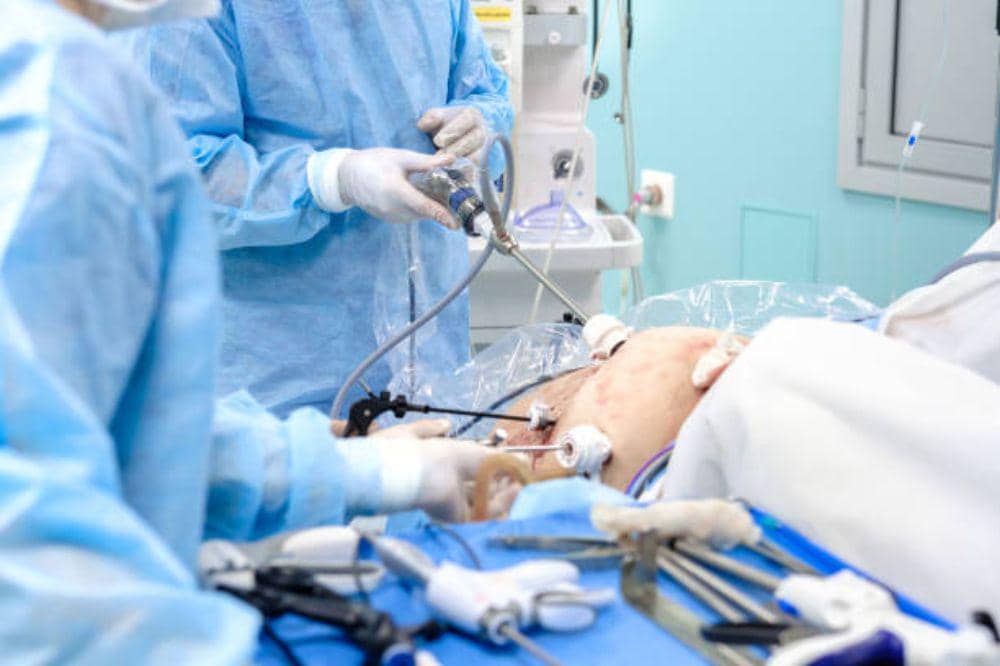 7 Jenis Perawatan Hernia yang Perlu Diketahui Sebelum Kondisi Memburuk