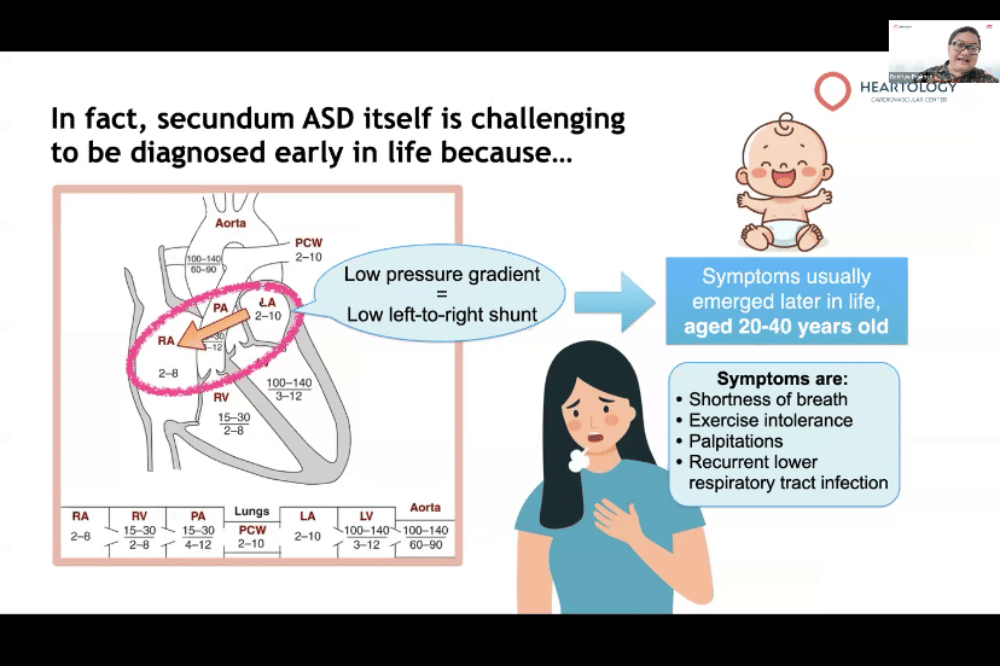 Pertama di Indonesia, Operasi MICS 3 Prosedur Berhasil pada Pasien Jantung ASD  (7).png