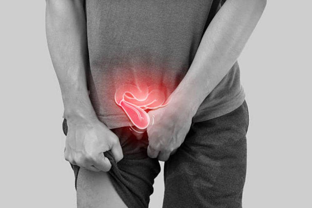 Apa Itu Hernia Inguinalis? Ketahui Gejala Awalnya!