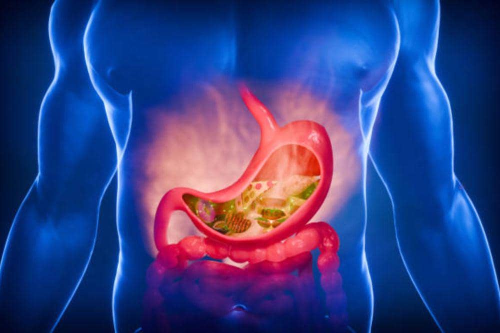 9 Gejala Hernia Hiatus, Keluhannya Mirip Asam Lambung!