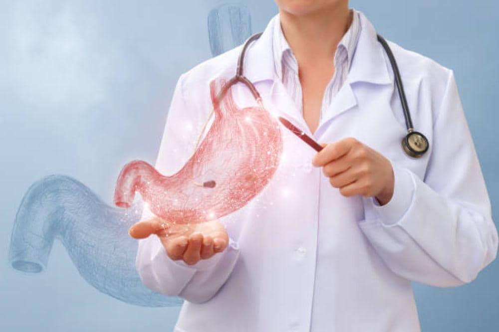 Apa Itu Hernia Hiatus? Kenali Kondisinya yang Sering Disalahartikan!