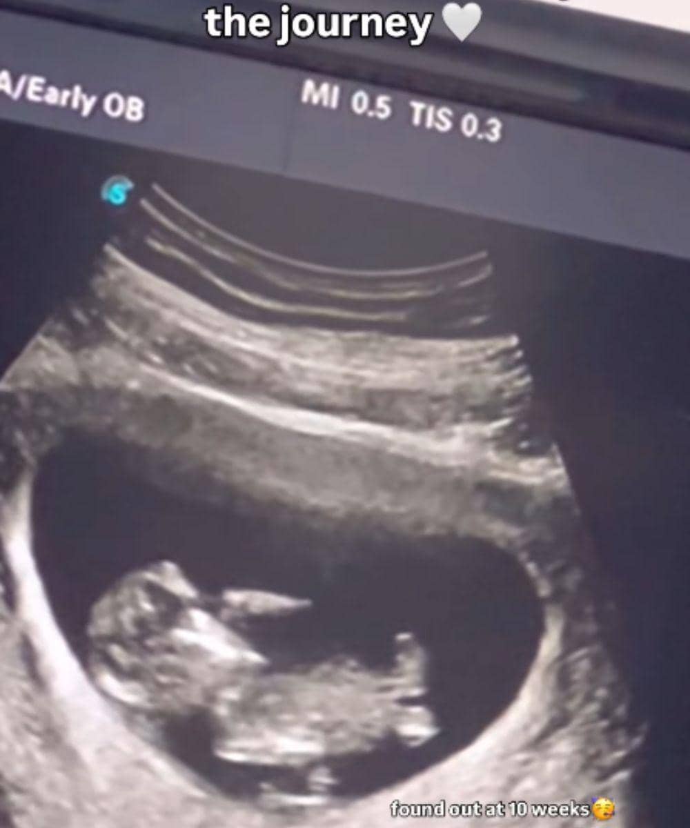 Instagram.com/kinalputridevi