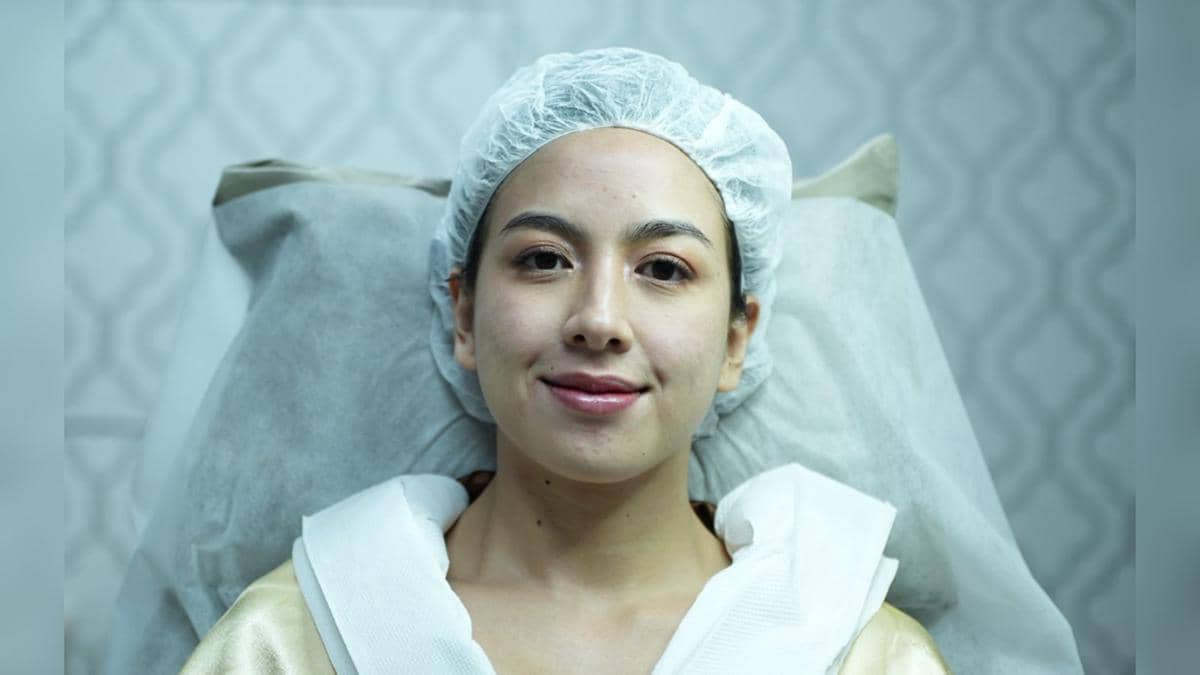 before after treatment Miracle Aesthetic Clinic