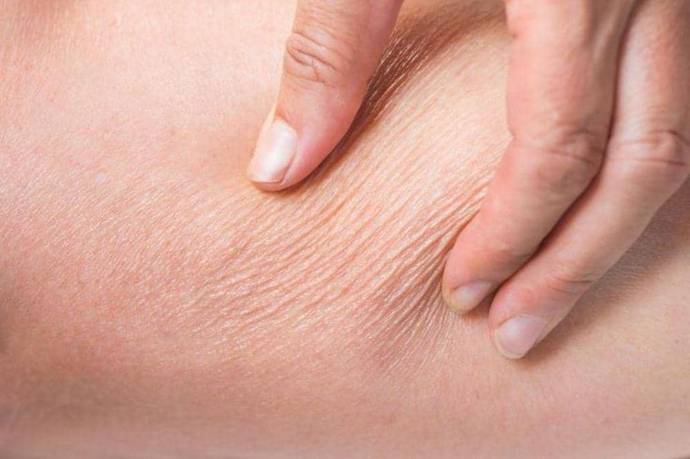  Kenapa Eksim di Kaki Tak Kunjung Sembuh? Kesalahan Perawatan Utamanya!