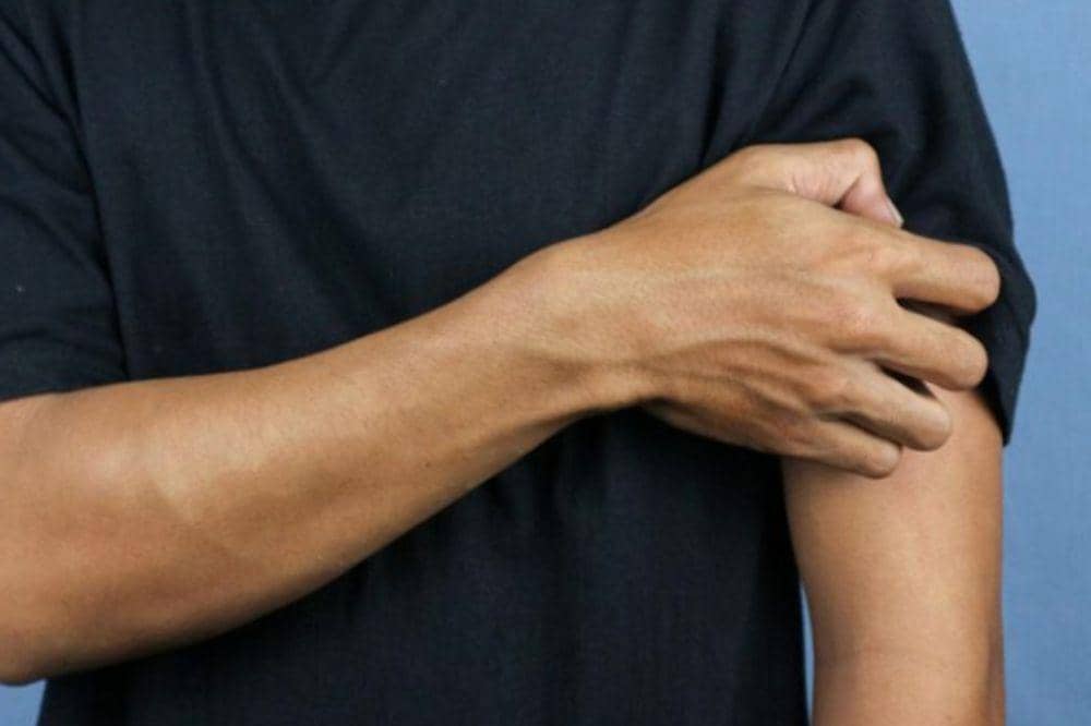 10 Penyebab Eksim Kering yang Sering Tidak Disadari