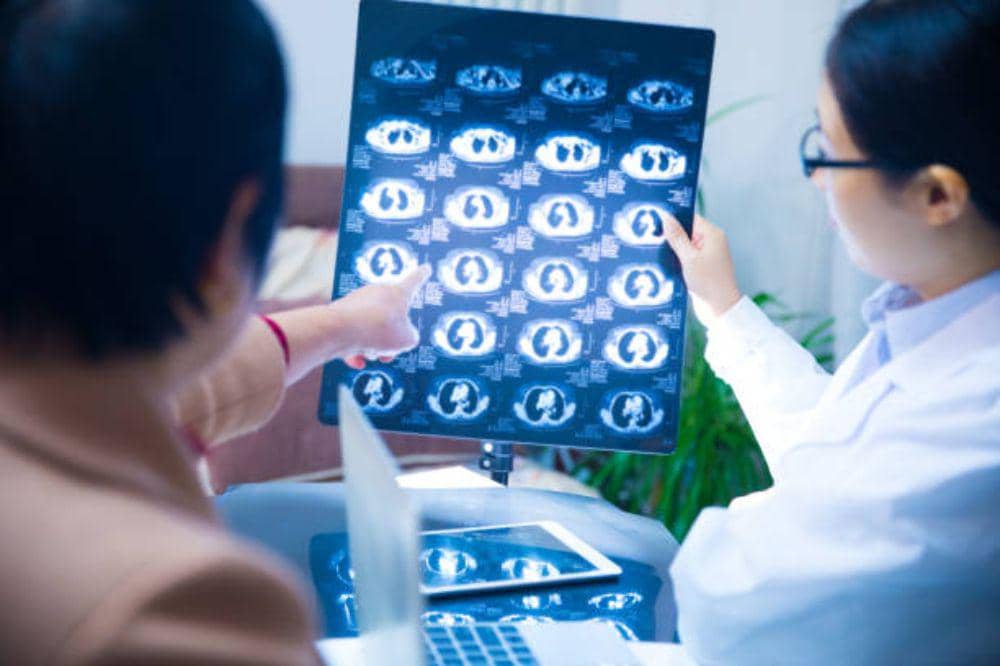 Kanker Payudara Stadium 4: Gejala Lanjut dan Upaya Penanganan