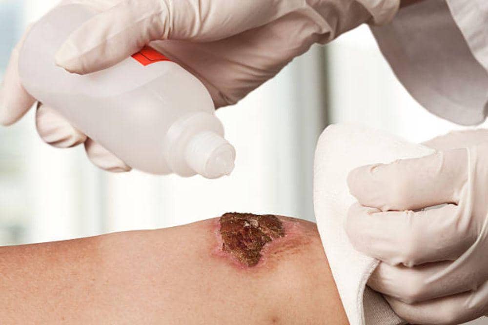 12 Ciri-Ciri Diabetes yang Sering Terlihat Sepele Tapi Fatal