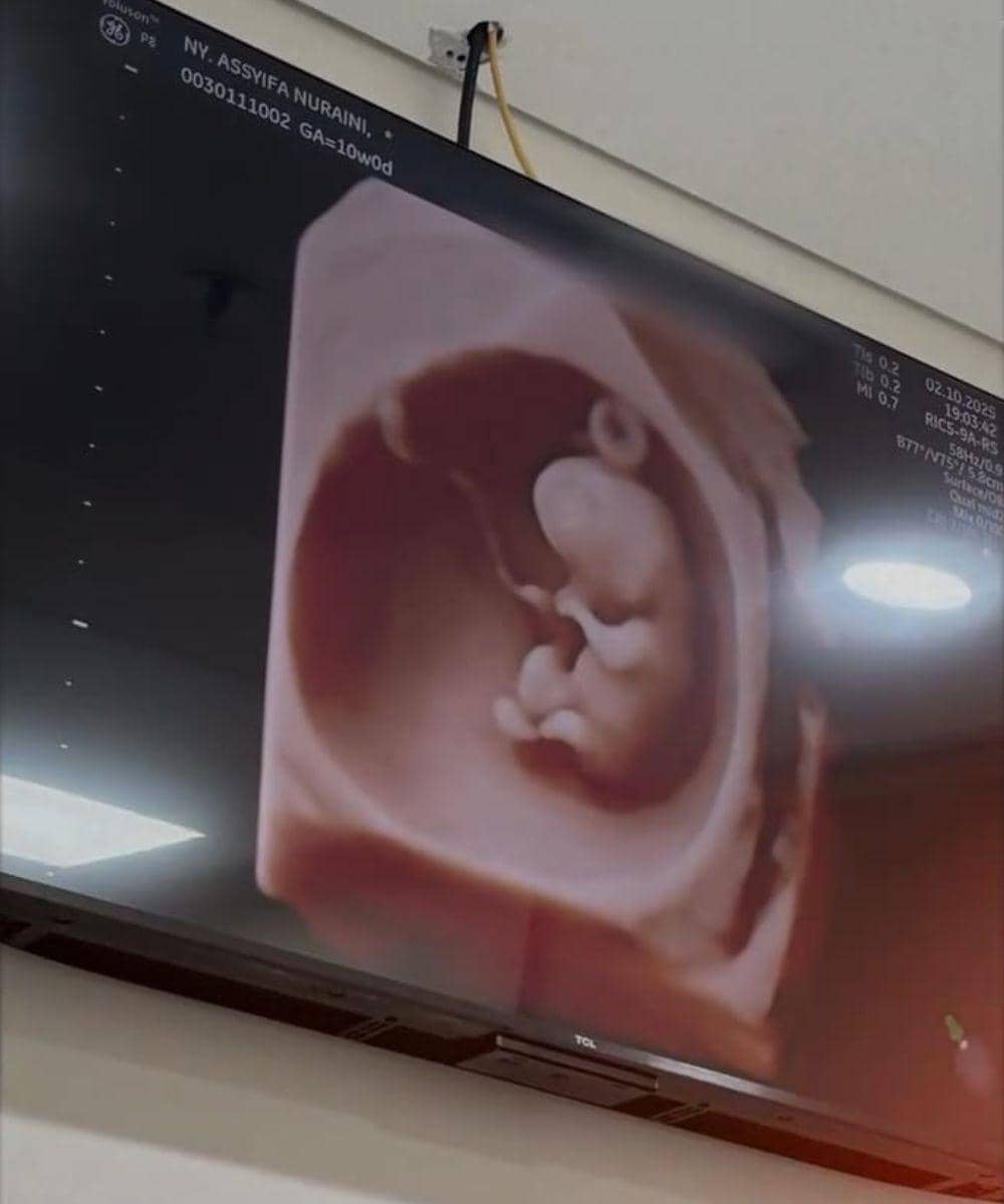 Instagram.com/syifaasyifaaa