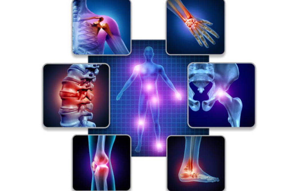 Artritis Reumatoid: Definisi, Gejala, Penyebab, dan Pengobatan