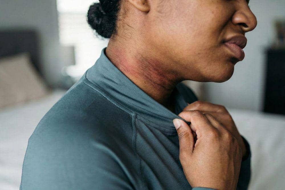 7 Penyebab Leher Hitam saat Hamil 4