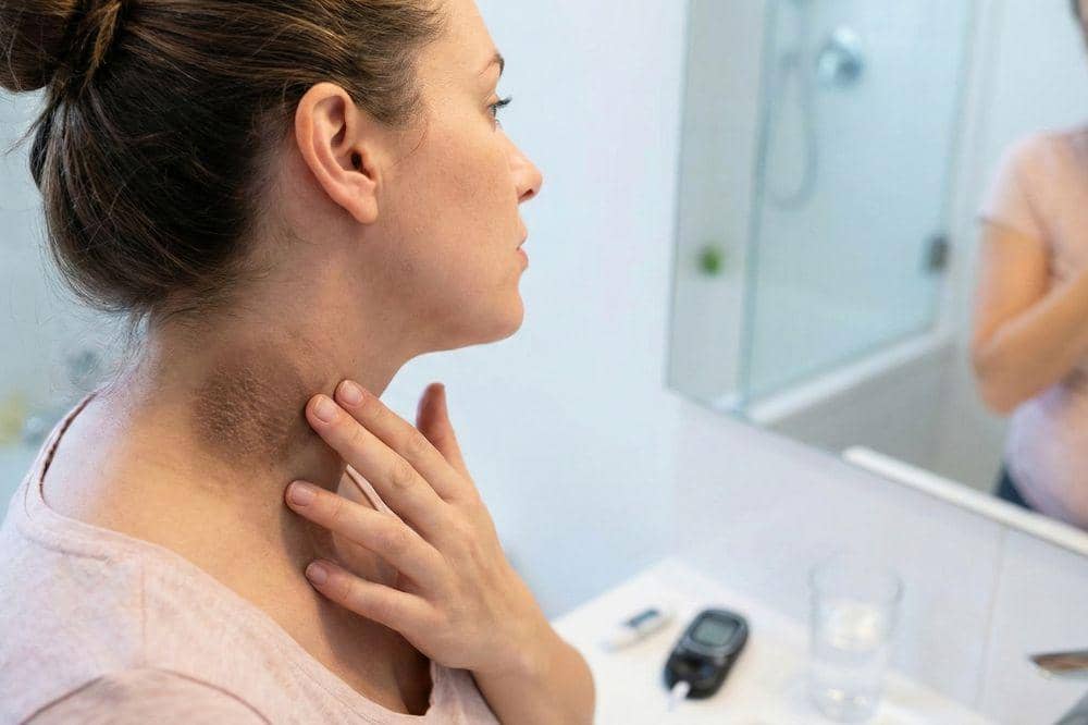 7 Penyebab Leher Hitam saat Hamil 5