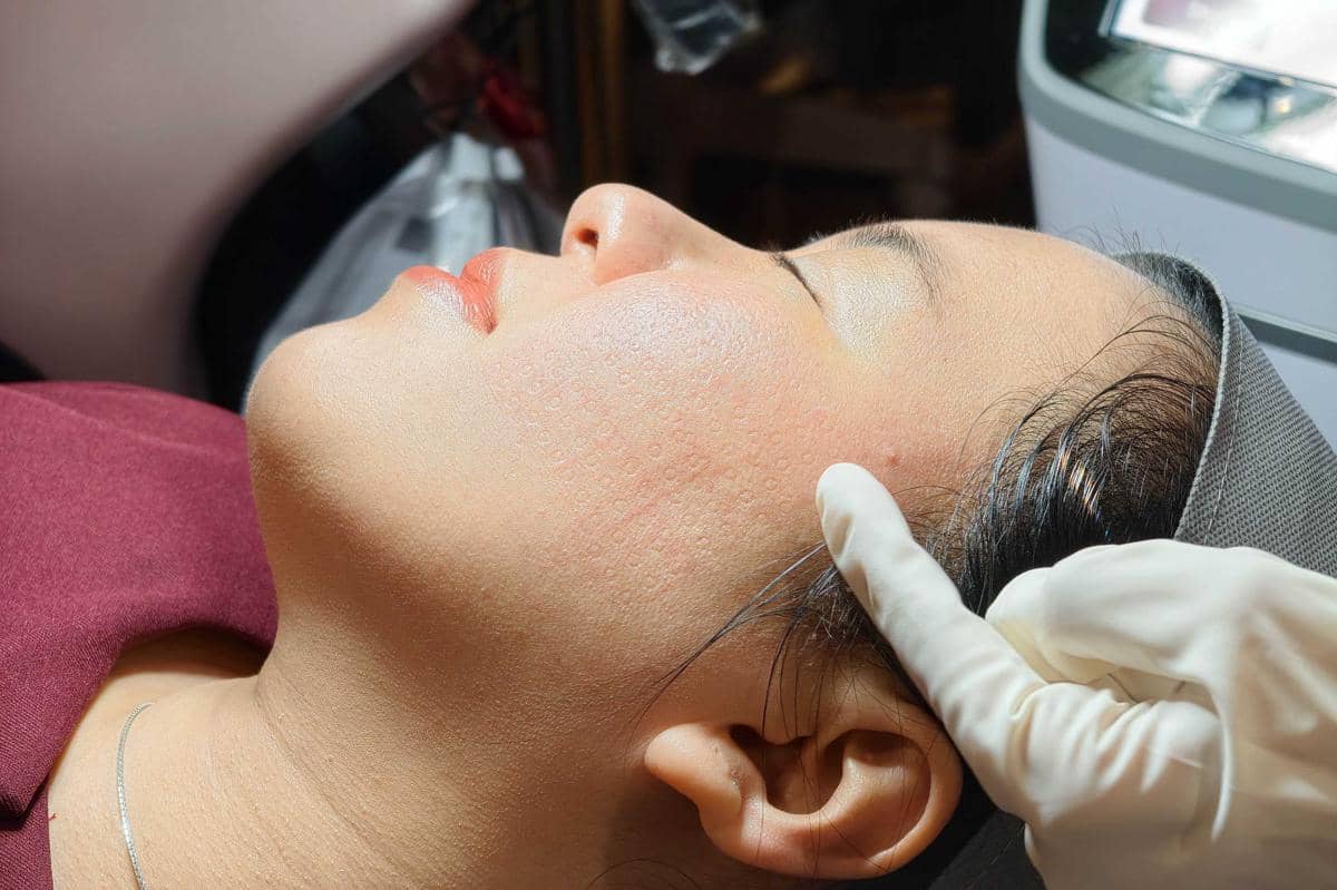 Dermies Max Kemang 4.jpg