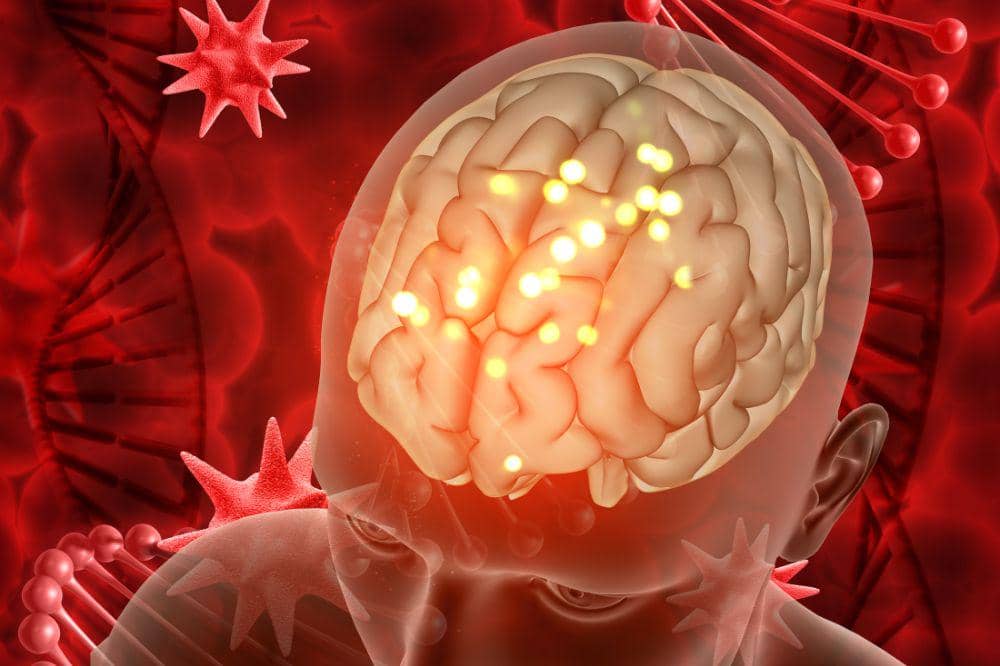 Stroke Hemoragik: Definisi, Gejala, Penyebab, dan Cara Pengobatannya!