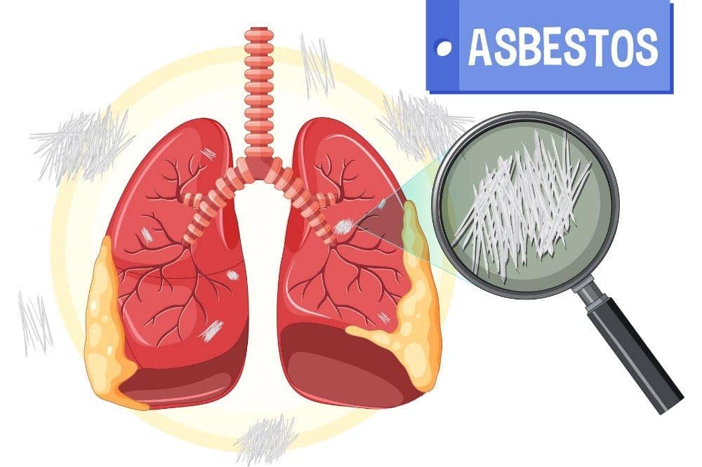7 Penyebab Kanker Paru-Paru yang Bisa Terjadi dari Lingkungan (2).jpg