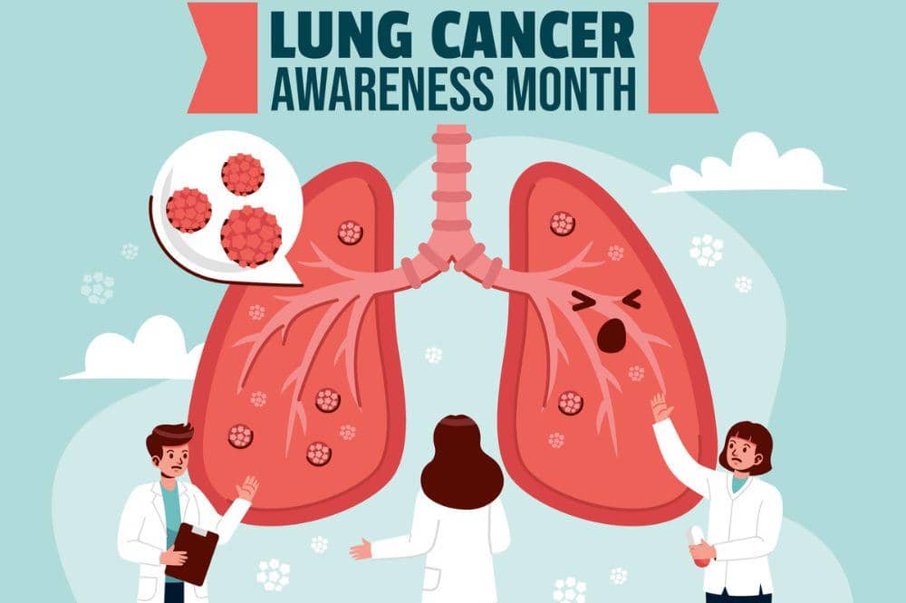 1 Agustus, Hari Kanker Paru-Paru Sedunia: Sejarah dan Upaya Pencegahan