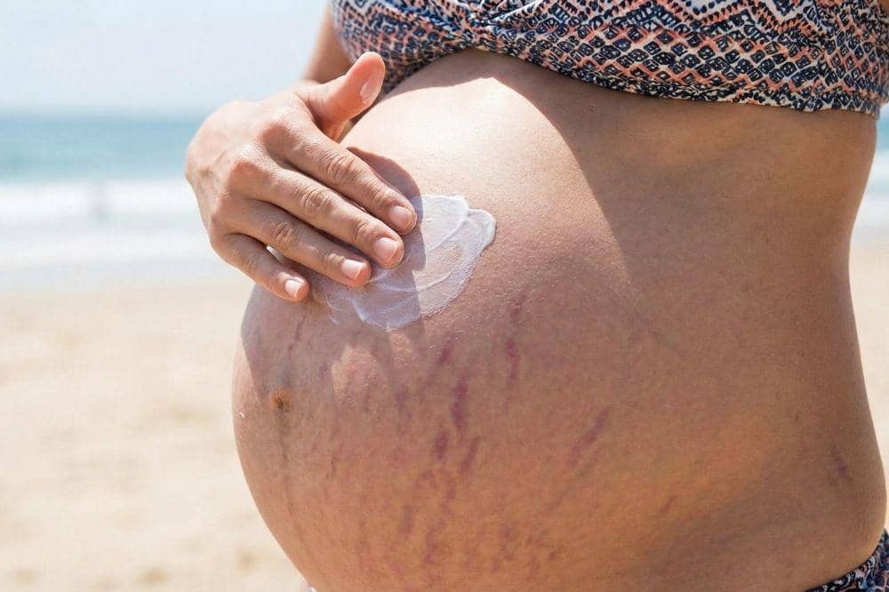 7 Bahaya Sinar UV untuk Ibu Hamil 5