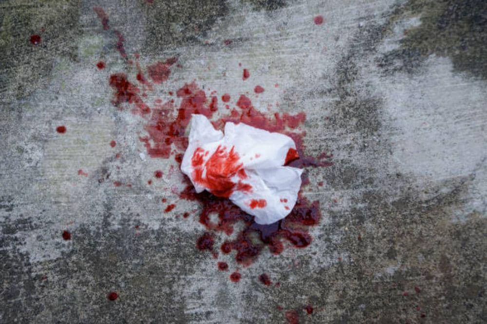 4 Tahapan Stadium Kanker Paru-Paru dan Dampaknya bagi Tubuh