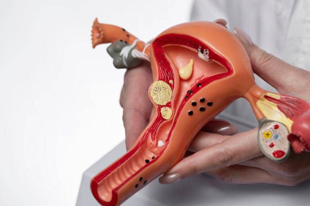 Gejala Kanker Serviks Stadium Awal.jpg