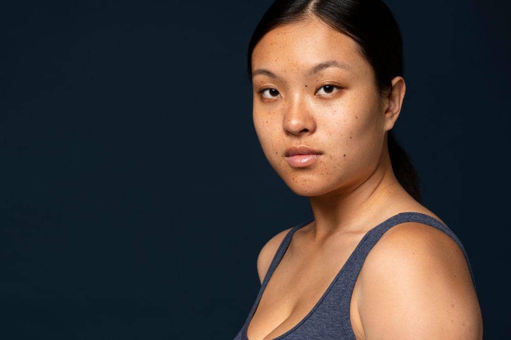 7 Ciri-Ciri Kanker Kulit Wajah dari Lesi hingga Luka Tak Sembuh