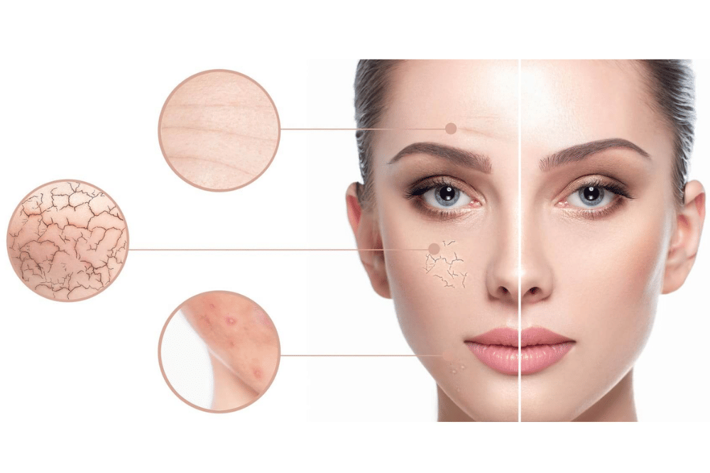 skincare collagen
